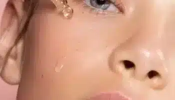 Glikolik Asit Gözenek Sıkılaştırma